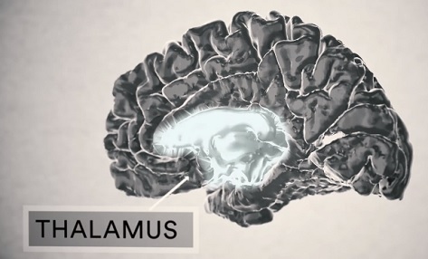 Co způsobuje esenciální třes? Odpověď na tuto otázku je stále poněkud nejasná. Vědci ale určili určitou část mozku, která, jak se zdá, je spojena s těmito třesy. Je to struktura hluboko v mozku nazývaná thalamus, která je zodpovědná za koordinaci a kontrolu svalové aktivity.