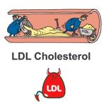 Jak na vysoký cholesterol? Takto ho dokážete srazit a nezvyšovat
