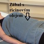 Zábal z ricinového oleje – na co je dobrý?