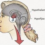 Hypofýza – podvěsek mozkový – funkce a nemoci (poruchy, nádory)