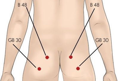 Akupresurní body v oblasti hýždí.