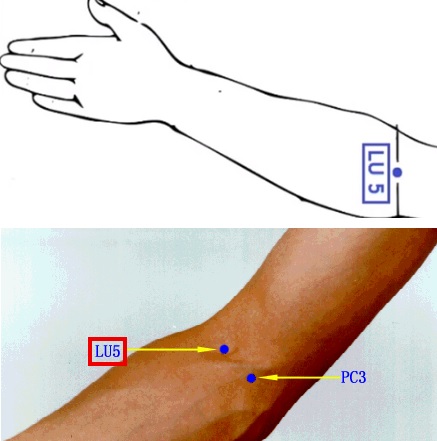 Akupunkturní bod LU 5