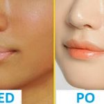 Jak se zbavit opálení na obličeji? Zkuste tyto domácí metody