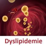 Dyslipidemie – příznaky, příčiny a léčba