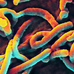 Ebola (hemoragická horečka Ebola) – příznaky, příčiny a léčba