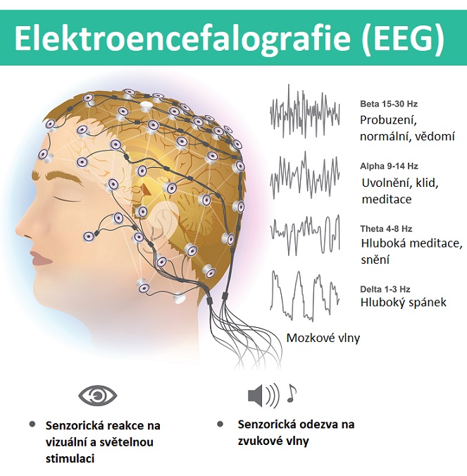 Elektroencefalografie (EEG) - ilustrace
