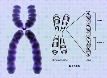 Syndrom křehkého (fragilního) chromozomu X - příznaky, příčiny a léčba