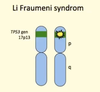 Syndrom Li-Fraumeni je vzácná porucha, která výrazně zvyšuje riziko vzniku několika druhů rakoviny.