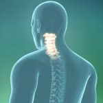 Osteochondróza páteře a kloubů – příznaky, příčiny a léčba + léčba přírodními prostředky a babskými radami