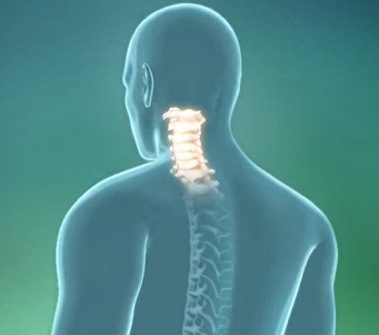 Osteochondróza páteře a kloubů - příznaky, příčiny a léčba