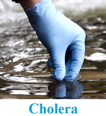Cholera se prakticky nevyskytuje (nebo výjimečně) v zemích prvního světa.