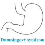 Dumpingový (dumping) syndrom – příznaky, příčiny a léčba