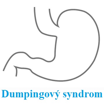 Jak si poradit s dumpingovým syndromem?