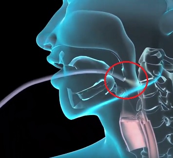 Obvykle se nazývá endoskopické vyšetření horního zažívacího traktu, esophagogastroduodenoscopy (EGD) se používá k diagnostice a léčbě stavů horního gastrointestinálního traktu.