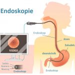 Endoskopie – co to je a co byste měli vědět?