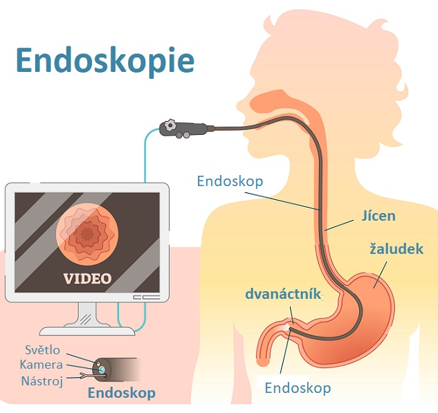 Endoskopická vyšetření nebývají mezi pacienty příliš oblíbená. Pro lékaře však mají velkou cenu.