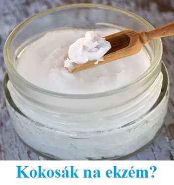 Pomůže kokosový olej s příznaky ekzému?