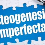 Osteogenesis imperfecta (nemoc křehkých kostí, nemoc lámavých kostí)  – příznaky, příčiny, typy a léčba