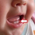 Esenciální oleje pro masírování dásní malých dětí – super když rostou první zoubky