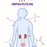 Příběh pacientky s homocystinurií