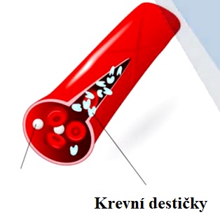 Krevní destičky pomáhají kontrolovat krvácení a podlitiny.