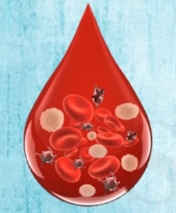 Paroxysmalní noční hemoglobinurie – praktické zkušenosti s léčbou