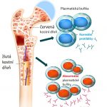 Mnohočetný myelom (plazmocytom) – příznaky, příčiny a léčba