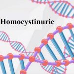 Homocystinurie – co je to? Příznaky, příčiny a léčba