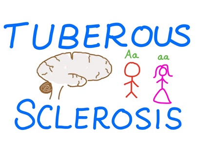 Komplex tuberózní sklerózy (TSC) - příčiny, příznaky, léčba a současná špičková medicína