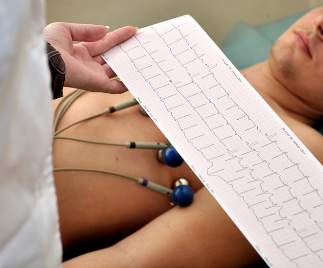 Elektrokardiogram (EKG) a jeho výsledky