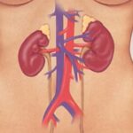 Glomerulonefritida – onemocnění glomerulů – příznaky, příčiny a léčba