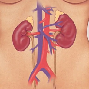 Glomerulonefritida - onemocnění glomerulů - příznaky, příčiny a léčba