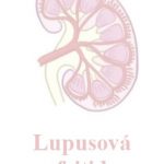 Lupusová nefritida (Lupus nephritis) – příznaky, příčiny a léčba