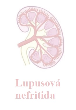 Lupusová nefritida (Lupus nephritis) - příznaky, příčiny a léčba