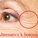Rizika botoxu + 8 alternativ k botoxu při léčbě vrásek