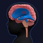 Co je hydrocefalus (nahromadění mozkomíšního moku) – příznaky, příčiny a léčba