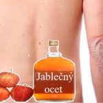 Jablečný ocet na psoriázu – může nějak pomoci?