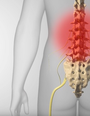 Lumbální spinální stenóza - příznaky, příčiny a léčba