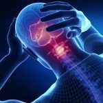 Cervikogenní bolest hlavy (přenesená bolest hlavy z oblasti krční páteře) – jak ji řešit?