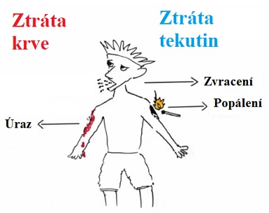 Hypovolemický šok - co je to - příznaky, příčiny a první pomoc