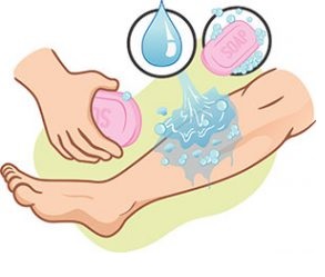 K vyčištění menších poranění a zranění použijte mýdlo a vodu.