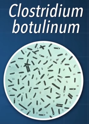 Clostridium botulinum - co tato bakterie může způsobit?