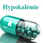 Hypokalémie – toto je 8 příznaků toho, že máte v těle málo draslíku