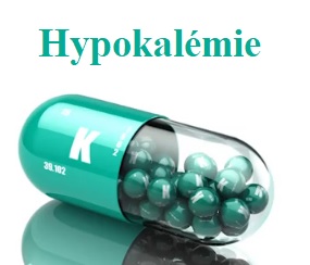 Hypokalémie - toto je 8 příznaků toho, že máte v těle málo draslíku