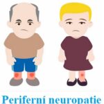 Periferní neuropatie – narušená funkce nervů v pažích a nohou – příznaky, příčiny a léčba