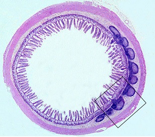 Peyerovy pláty (někdy též Peyerovy plaky, zkráceně PP) jsou organizovanou lymfoidní tkání tenkého střeva, tvořící součást slizničního imunitního systému.