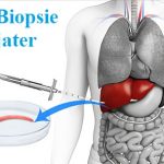 Biopsie jater – proč se dělá a co se při ní děje?