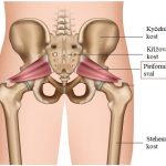 Piriformis syndrom (syndrom hruškovitého, hýžďového svalu) – co je to, jaké má příznaky a jak na něj?