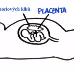 Odběr choriových klků (CVS) – co je to, kdy a proč se používá?