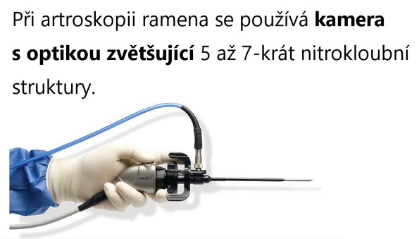 jaké jsou artroskopické možnosti ošetření ramena?